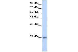 WB Suggested Anti-MIF4GD Antibody Titration:  1. (MIF4GD Antikörper  (C-Term))