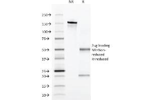 SDS-PAGE Analysis Purified Alpha-1-Antitrypsin Mouse Monoclonal Antibody (AAT/1379). (SERPINA1 Antikörper)