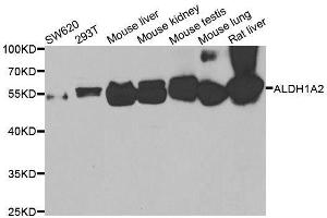 Western blot analysis of extracts of various cell lines, using ALDH1A2 antibody. (ALDH1A2 Antikörper  (AA 1-180))