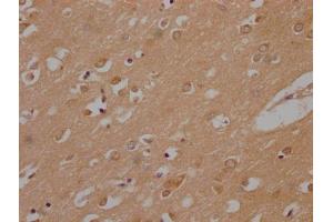 IHC image of ABIN7140049 diluted at 1:200 and staining in paraffin-embedded human brain tissue performed on a Leica BondTM system. (LPPR1 Antikörper  (AA 51-66))