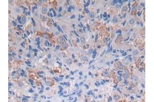 Detection of PROZ in Mouse Ovary Tissue using Polyclonal Antibody to Protein Z (PROZ)