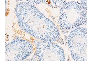 ABIN6267267 at 1/100 staining mouse testicular tissue sections by IHC-P.