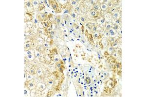 Immunohistochemistry of paraffin-embedded Human liver injury using ERG antibody at dilution of 1:100 (x400 lens). (ERG Antikörper)