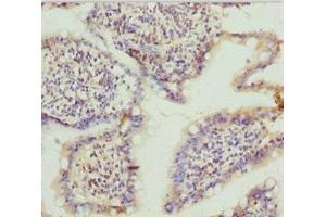 Immunohistochemistry of paraffin-embedded human small intestine tissue using ABIN7171763 at dilution of 1:100 (TNS3 Antikörper  (AA 1-240))