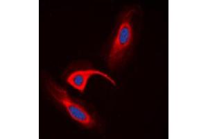 Immunofluorescent analysis of CBR1 staining in HeLa cells. (CBR1 Antikörper  (Center))