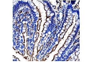 IHC analysis of CD13/ANPEP using anti-CD13/ANPEP antibody (ABIN7600088).