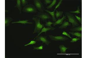 Immunofluorescence of purified MaxPab antibody to CTDSP2 on HeLa cell.