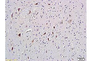 Formalin-fixed and paraffin embedded rat brain labeled with Anti-GRM5/mGluR5 Polyclonal Antibody, Unconjugated (ABIN673914) followed by conjugation to the secondary antibody and DAB staining (Metabotropic Glutamate Receptor 5 Antikörper  (AA 201-300))