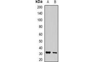 Western blot analysis of PA28 gamma expression in MCF7 (A), PC12 (B) whole cell lysates. (PSME3 Antikörper)