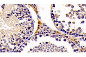 Detection of HMGCS2 in Mouse Testis Tissue using Polyclonal Antibody to Hydroxymethylglutaryl Coenzyme A Synthase 2, Mitochondrial (HMGCS2) (HMGCS2 Antikörper  (AA 1-167))