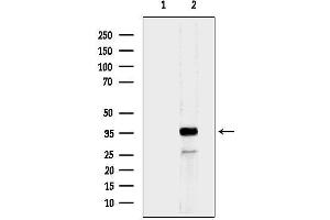 anti-Mitochondrial Ribosomal Protein L44 (MRPL44) antibody