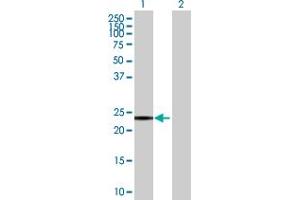 Western Blot analysis of SNAP23 expression in transfected 293T cell line by SNAP23 MaxPab polyclonal antibody. (SNAP23 Antikörper  (AA 1-211))