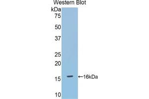 Western blot analysis of the recombinant protein. (DBR1 Antikörper  (AA 133-241))