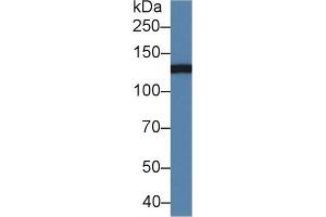 Detection of CD11b in Mouse Serum using Polyclonal Antibody to Integrin Alpha M (CD11b) (CD11b Antikörper  (AA 808-931))