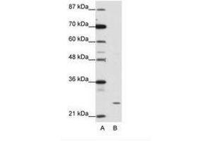 Image no. 1 for anti-Zinc Finger Protein 253 (ZNF253) (C-Term) antibody (ABIN202147)