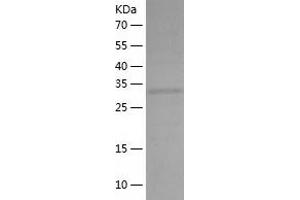 Western Blotting (WB) image for Microtubule-Associated Protein, RP/EB Family, Member 2 (MAPRE2) (AA 1-327) protein (His tag) (ABIN7287290) (MAPRE2 Protein (AA 1-327) (His tag))