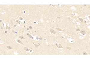 Detection of AKAP12 in Human Cerebrum Tissue using Polyclonal Antibody to A Kinase Anchor Protein 12 (AKAP12)