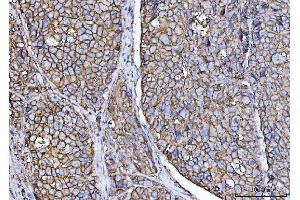 IHC analysis of CD147/Emmprin using anti-CD147/Emmprin antibody (ABIN7599997). (CD147 Antikörper  (AA 138-323))