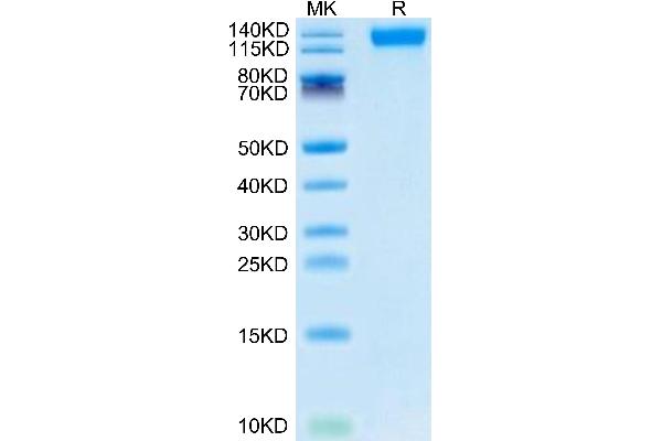 SARS-CoV-2 Spike S1 Protein (B.1.1.529 - Omicron) (His tag)