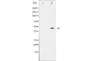 Western blot analysis of E2F1 expression in Etoposide treated HeLa whole cell lysates,The lane on the left is treated with the antigen-specific peptide. (E2F1 Antikörper  (C-Term))