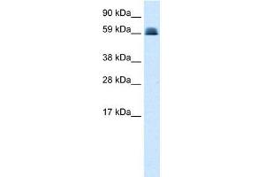 Human Lung; WB Suggested Anti-ZNF499 Antibody Titration: 0. (ZBTB45 Antikörper  (Middle Region))