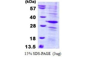 Image no. 1 for Adenosylmethionine Decarboxylase 1 (AMD1) protein (His tag) (ABIN1098638)