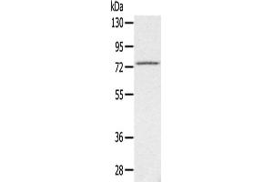 Gel: 6 % SDS-PAGE,Lysate: 40 μg,Primary antibody: ABIN7192448(SLC26A5 Antibody) at dilution 1/200 dilution,Secondary antibody: Goat anti rabbit IgG at 1/8000 dilution,Exposure time: 3 minutes (SLC26A5 Antikörper)