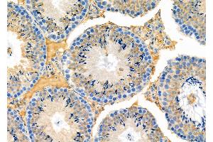 ABIN6263228 and ABIN6273139 at 1/100 staining Mouse testis tissue by IHC-P.