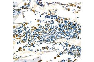 Immunohistochemistry of paraffin embedded mouse bone using CD110 (ABIN7074718) at dilution of 1:1000 (400x lens) (MPL Antikörper)