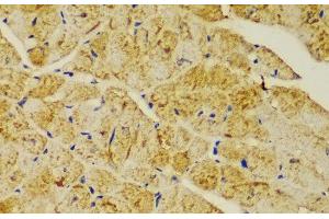 Immunohistochemistry of paraffin-embedded Mouse heart using ACTN1 Polyclonal Antibody at dilution of 1:100 (40x lens). (ACTN1 Antikörper)