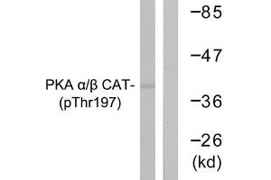 Western blot analysis of extracts from mouse brain cells using PKA α/β CAT (Phospho-Thr197) Antibody. (PRKACA Antikörper  (pThr197))