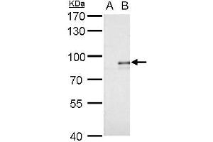 WB Image Alkyl-DHAP synthase antibody detects Alkyl-DHAP synthase protein by western blot analysis. (AGPS Antikörper)