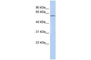 C6ORF182 antibody used at 1 ug/ml to detect target protein. (CEP57L1 Antikörper  (Middle Region))