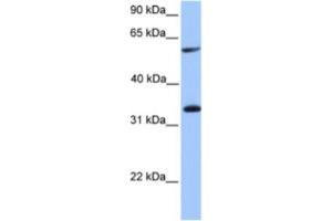 Western Blotting (WB) image for anti-Testis-Specific serine Kinase Substrate (TSKS) antibody (ABIN2463605) (TSKS Antikörper)