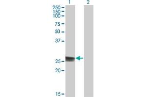 Western Blot analysis of TK1 expression in transfected 293T cell line by TK1 monoclonal antibody (M05), clone 3F9.