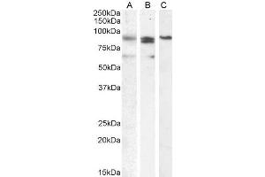ABIN571072 (0. (PRDM1 Antikörper  (Internal Region))