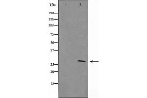 Western blot analysis on NIH-3T3 cell lysate using Granzyme B Antibody,The lane on the left is treated with the antigen-specific peptide.