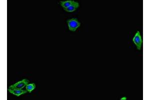 Immunofluorescent analysis of HepG2 cells using ABIN7153773 at dilution of 1:100 and Alexa Fluor 488-congugated AffiniPure Goat Anti-Rabbit IgG(H+L) (GMIP Antikörper  (AA 719-858))