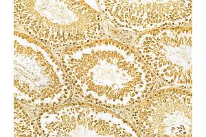 ABIN6263265 and ABIN6268849 at 1/100 staining Rat testis tissue by IHC-P.