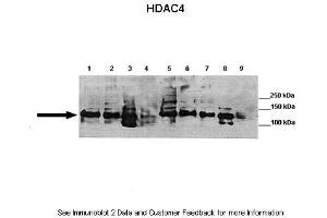 Lanes:   Lane 1: 40ug mouse brain, synaptosome lysate  Lane 2: 40ug mouse brain, membrane fraction  Lane 3: 40ug mouse brain, cytoplasm fraction  Lane 4: 40ug mouse brain, nuclear fraction  Lane 5: 40ug mouse brain, post synaptic density fraction  Lane 6: 40ug mouse brain, synaptosome lysate  Lane 7: 40ug mouse brain, membrane fraction  Lane 8: 40ug mouse brain, cytoplasm fraction  Lane 9: 40ug mouse brain, nuclear fraction   Primary Antibody Dilution:   1:1000  Secondary Antibody:   Goat anti-rabbit HRP  Secondary Antibody Dilution:   1:2000  Gene Name:   Hdac4  Submitted by:   Wen-Cheng Xiong, Georgia Health Sciences University (HDAC4 Antikörper  (C-Term))