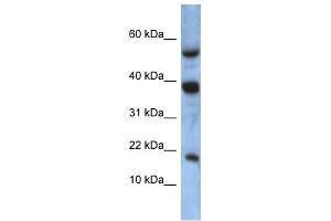 ATXN7L1 antibody used at 1 ug/ml to detect target protein. (ATXN7L1 Antikörper  (Middle Region))