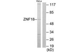 Western blot analysis of extracts from HeLa cells, using ZNF18 Antibody. (ZNF18 Antikörper  (AA 261-310))