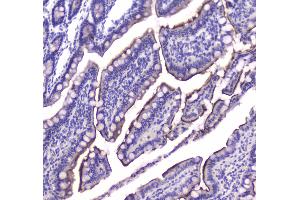 IHC analysis of Cannabinoid Receptor I using anti-Cannabinoid Receptor I antibody . (CNR1 Antikörper  (AA 1-75))