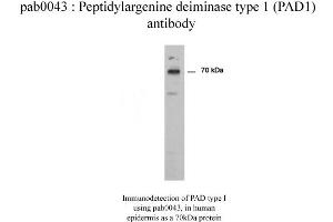 Image no. 2 for anti-Peptidyl Arginine Deiminase, Type I (PADI1) antibody (ABIN346990) (PADI1 Antikörper)