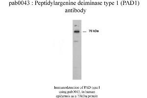 PADI1 Antikörper