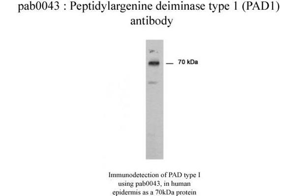 PADI1 Antikörper