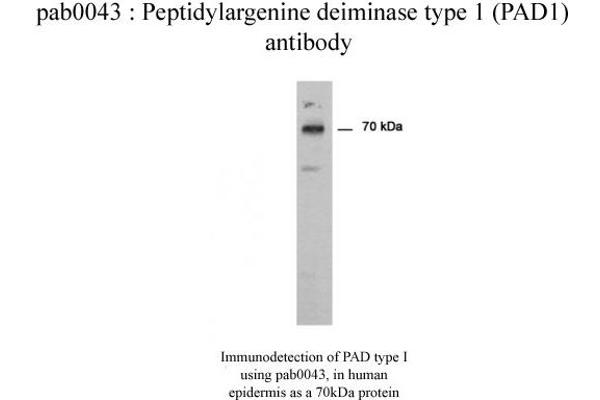 PADI1 antibody