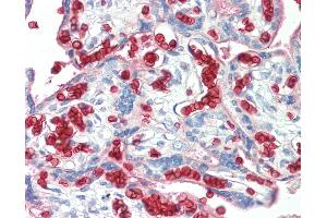 Anti-Erythrocytes antibody IHC staining of human placenta. (Erythrocytes Antikörper)