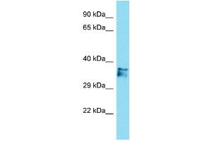 Host: Rabbit Target Name: C14orf79 Sample Type: Jurkat Whole Cell lysates Antibody Dilution: 1. (C14ORF79 Antikörper  (N-Term))