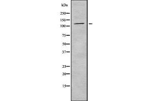 Western blot analysis of ICAM3 using HepG2 whole  lysates. (ICAM-3/CD50 Antikörper  (Internal Region))